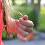 Can Diabetes Cause Hair Loss